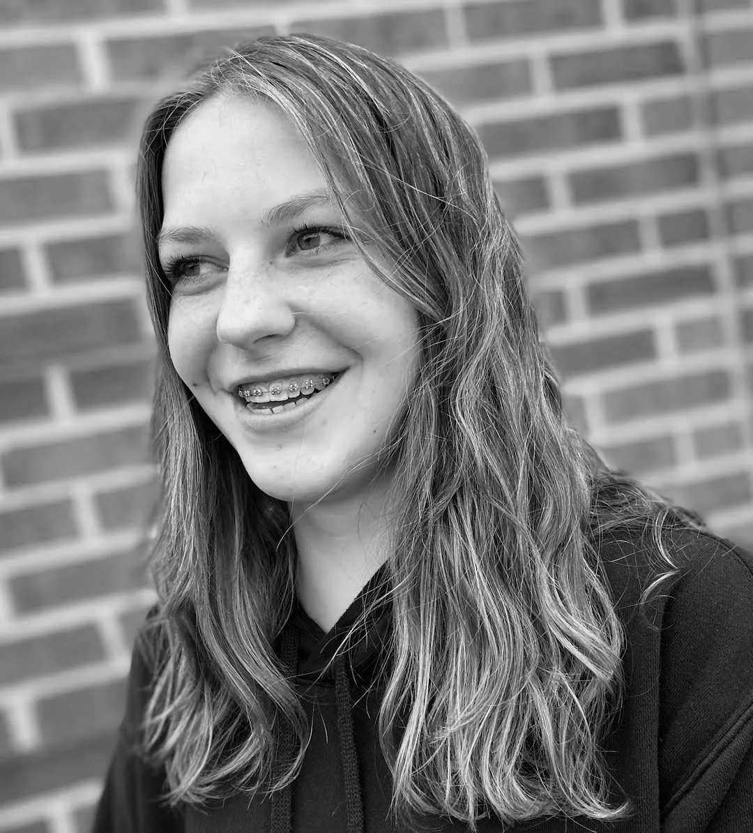 Braces for Adults Arlington, Woodbridge, Ruckersville, Waynesboro VA