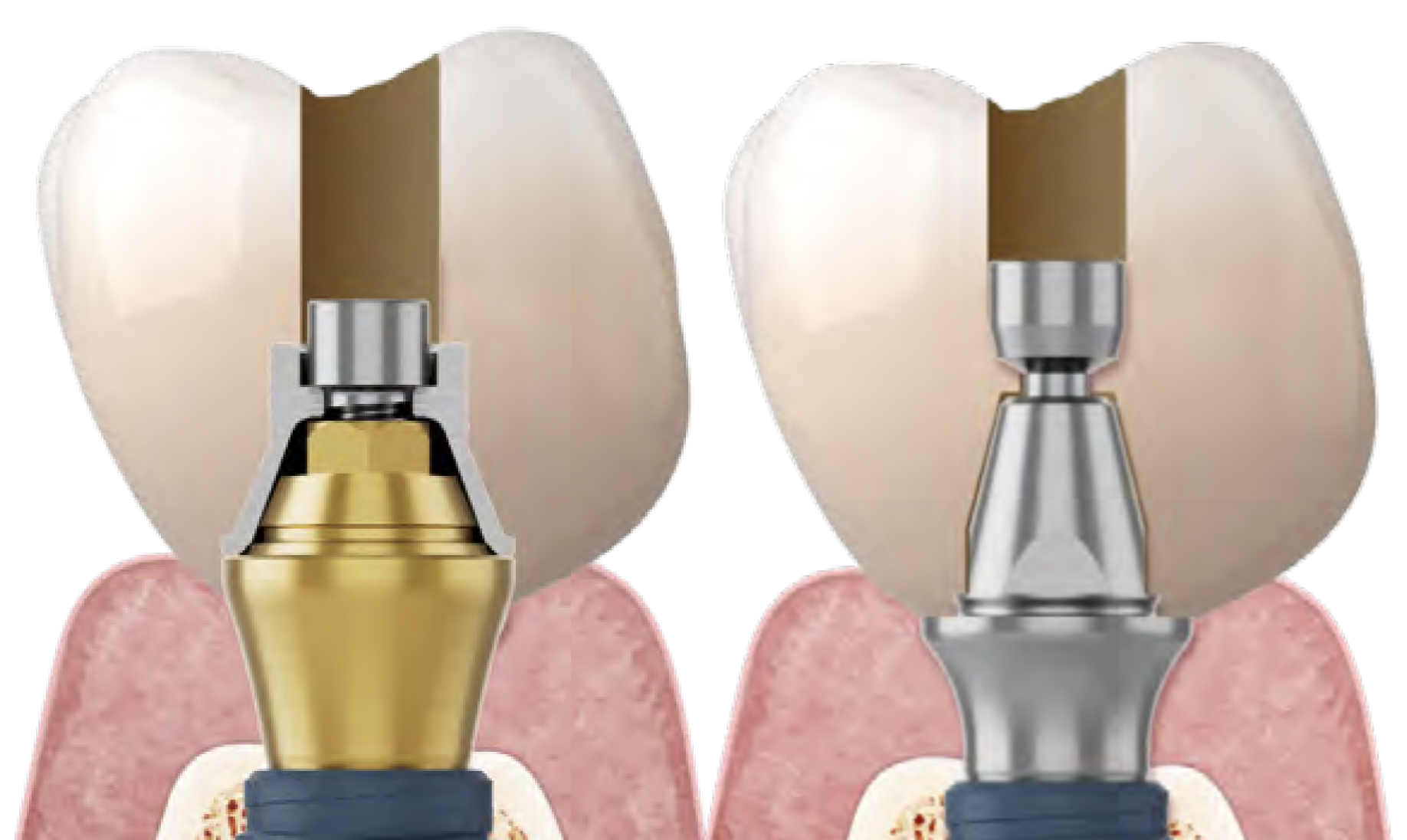 Screenshot 2026-03-25 at 14.20.04.png