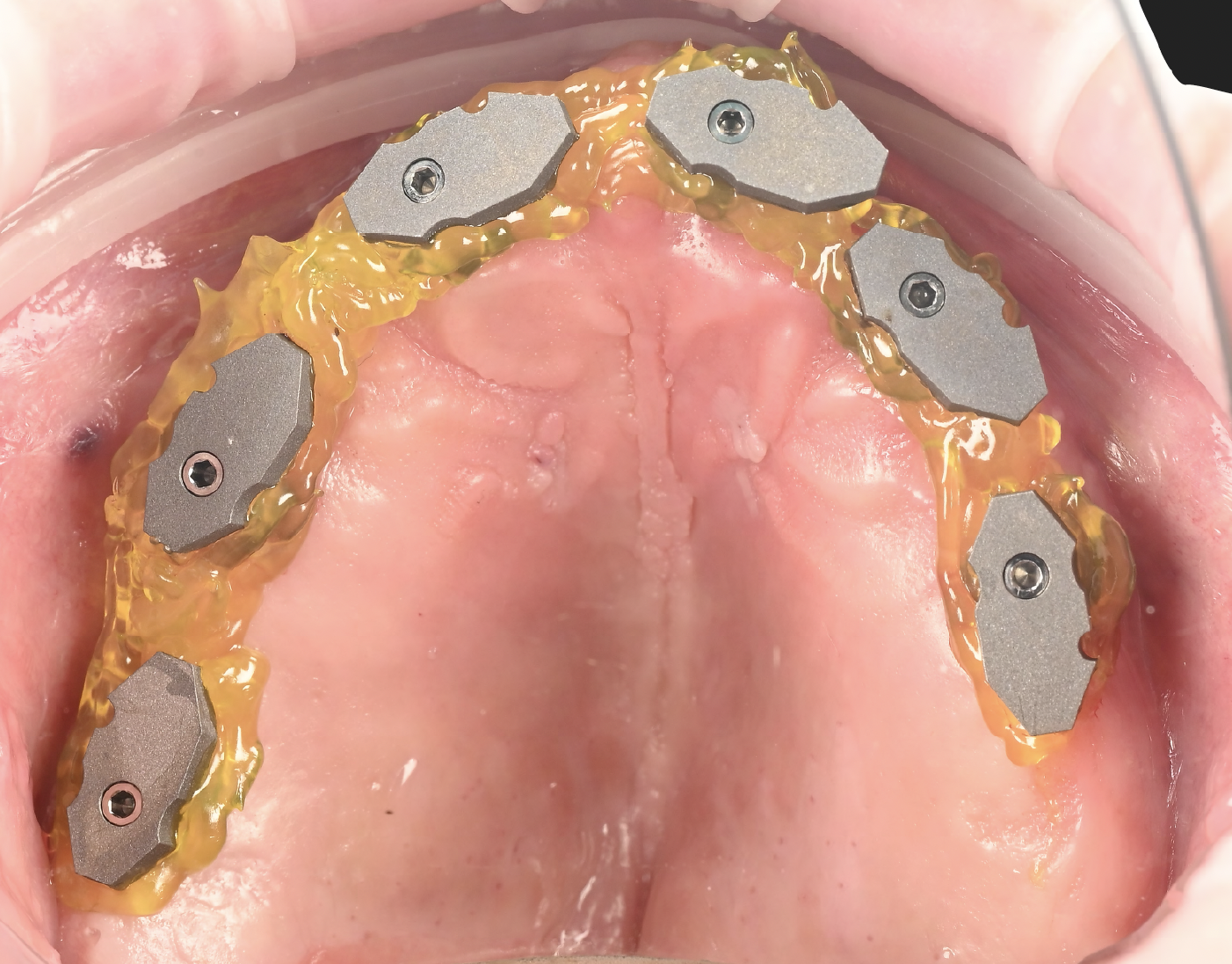 Screenshot 2026-03-25 at 14.20.28.png