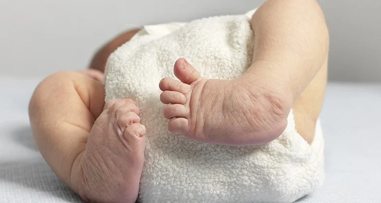 Clubfoot: Understanding the Condition and Treatment Options