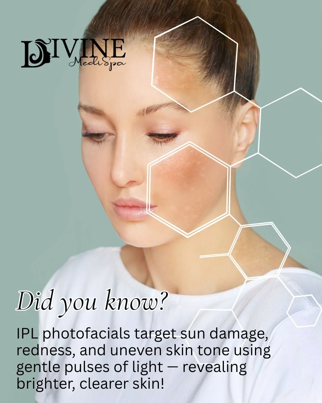 Brighter Skin with IPL

 ✨ Did you know? IPL photofacials target sun damage, redness, and uneven tone &mdash; revealing brighter, healthier skin!

At Divine MediSpa, we use advanced IPL technology for safe, effective results that leave your complexio