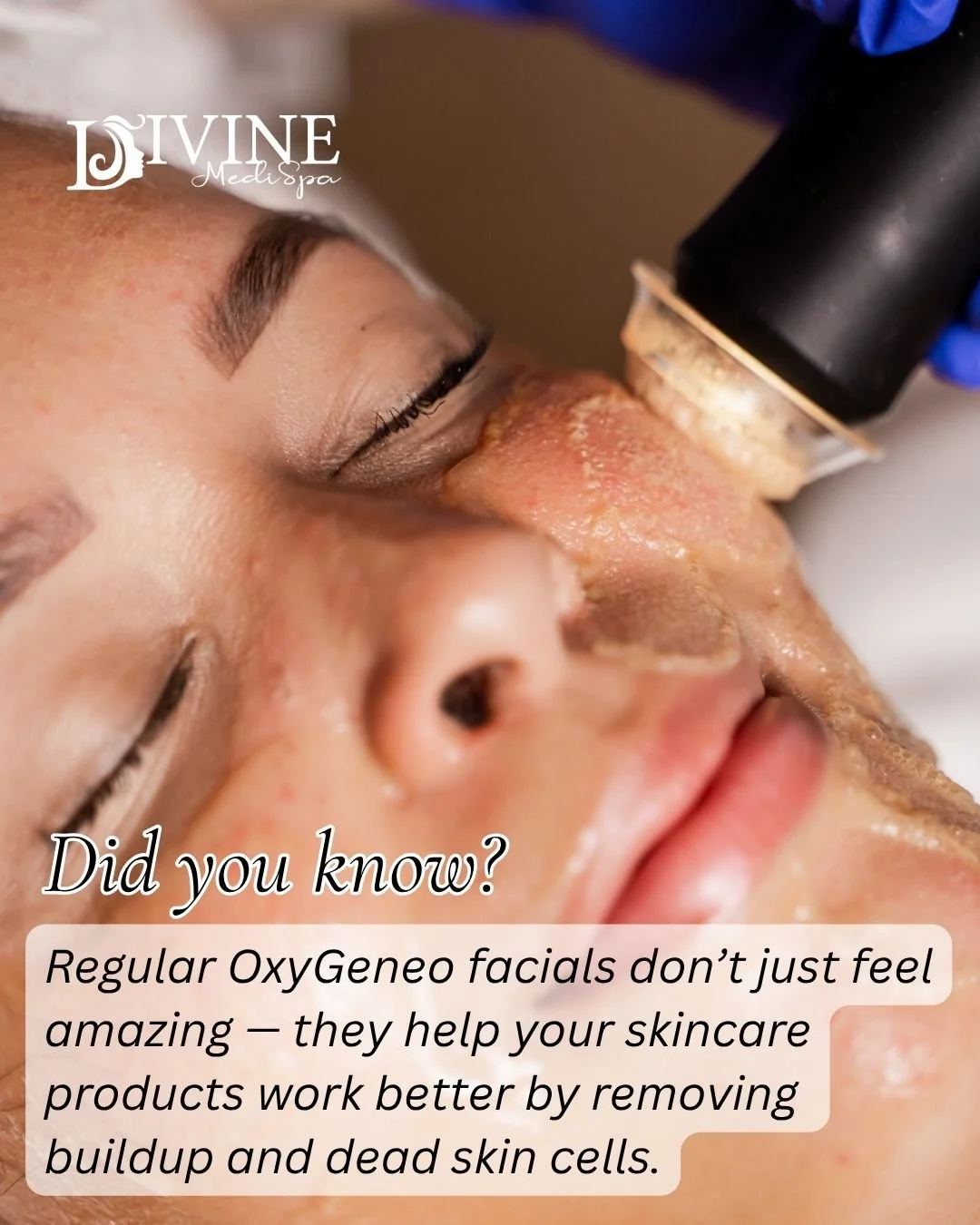 Facials That Work

 💧 Did you know? Regular OxyGeneo facials help your skincare products absorb better by removing buildup and dead skin cells.

At Divine MediSpa, our OxyGeneo medical facials with LED therapy target your unique skin needs for long-