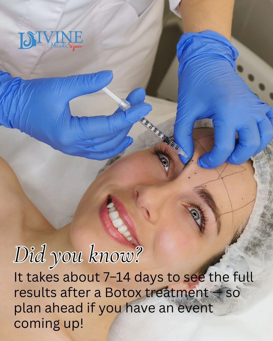 🌟 Did you know? It takes about 7&ndash;14 days to see full Botox results &mdash; perfect if you&rsquo;ve got an event coming up!

At Divine MediSpa, we&rsquo;ll help you plan your appointments so you look your best when it matters most. 💕