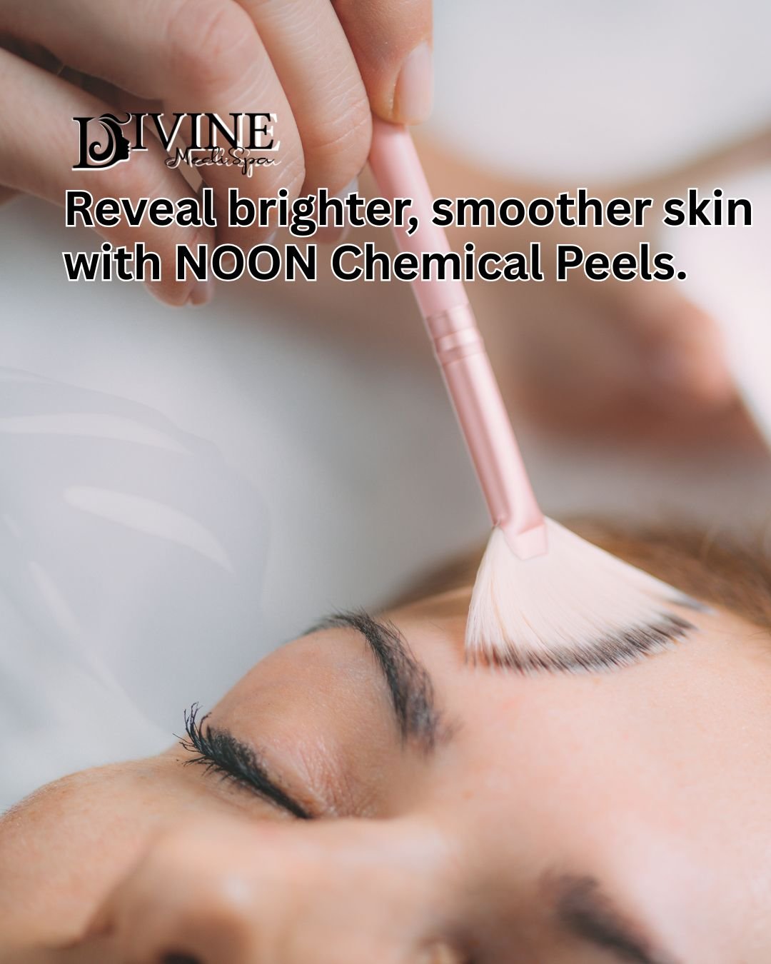 Reveal brighter, smoother skin with NOON Chemical Peels.
Formulated by NOON Aesthetics, these advanced peels are designed to deliver powerful results while minimizing irritation.

They help improve:
 ✨ Uneven skin tone
 ✨ Dull or tired skin
 ✨ Acne a