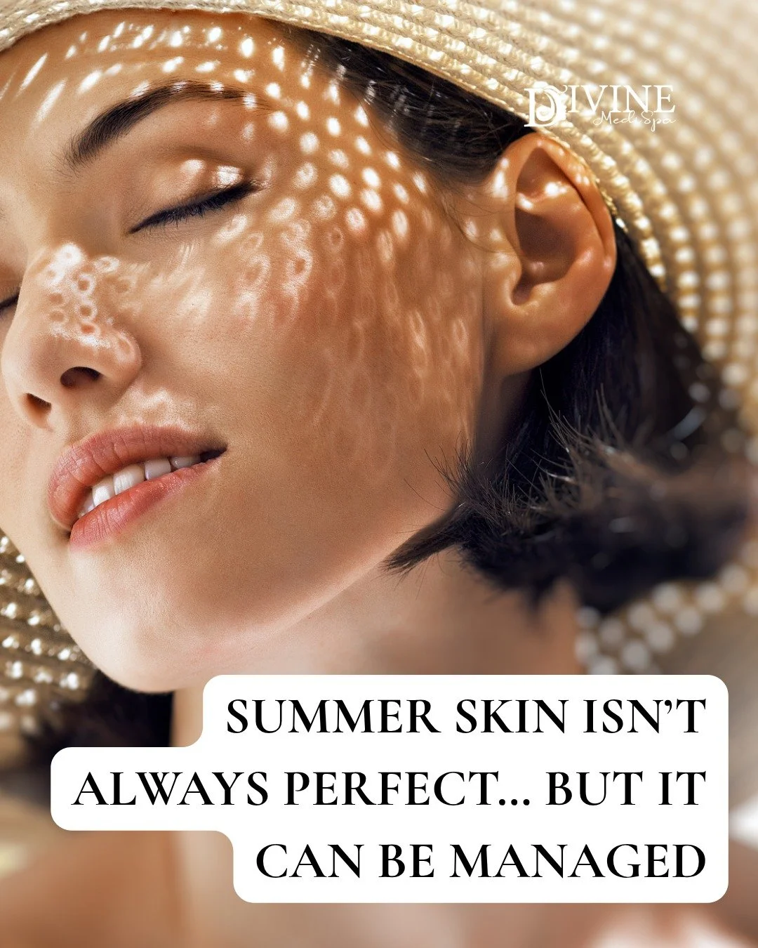 ☀️ Summer Skin Isn&rsquo;t Always Perfect&hellip; But It Can Be Managed

Heat, humidity, and sun exposure can take a toll on your skin&mdash;leading to concerns like:

✨ Increased pigmentation &amp; sun spots
✨ Oily, congested skin &amp; breakouts
✨ 