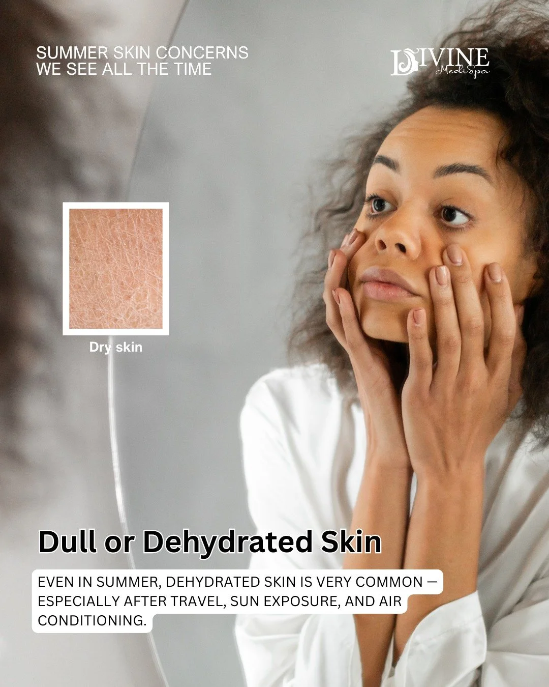 ✨ Dry &amp; Dehydrated Skin
 Even in summer, dehydrated skin is extremely common from sun, travel, and air conditioning.

✨ Treatments we love:
 &bull; Hydrating OxyGeneo facials
 &bull; Skin rejuvenation treatments
 &bull; Medical-grade hydration pr