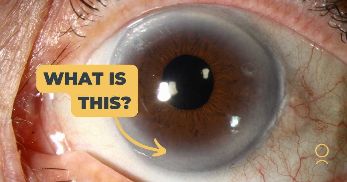 Cloudy Corneas: The Cause of White Spots on Your Pet's Eyes - Veterinary  Vision Center