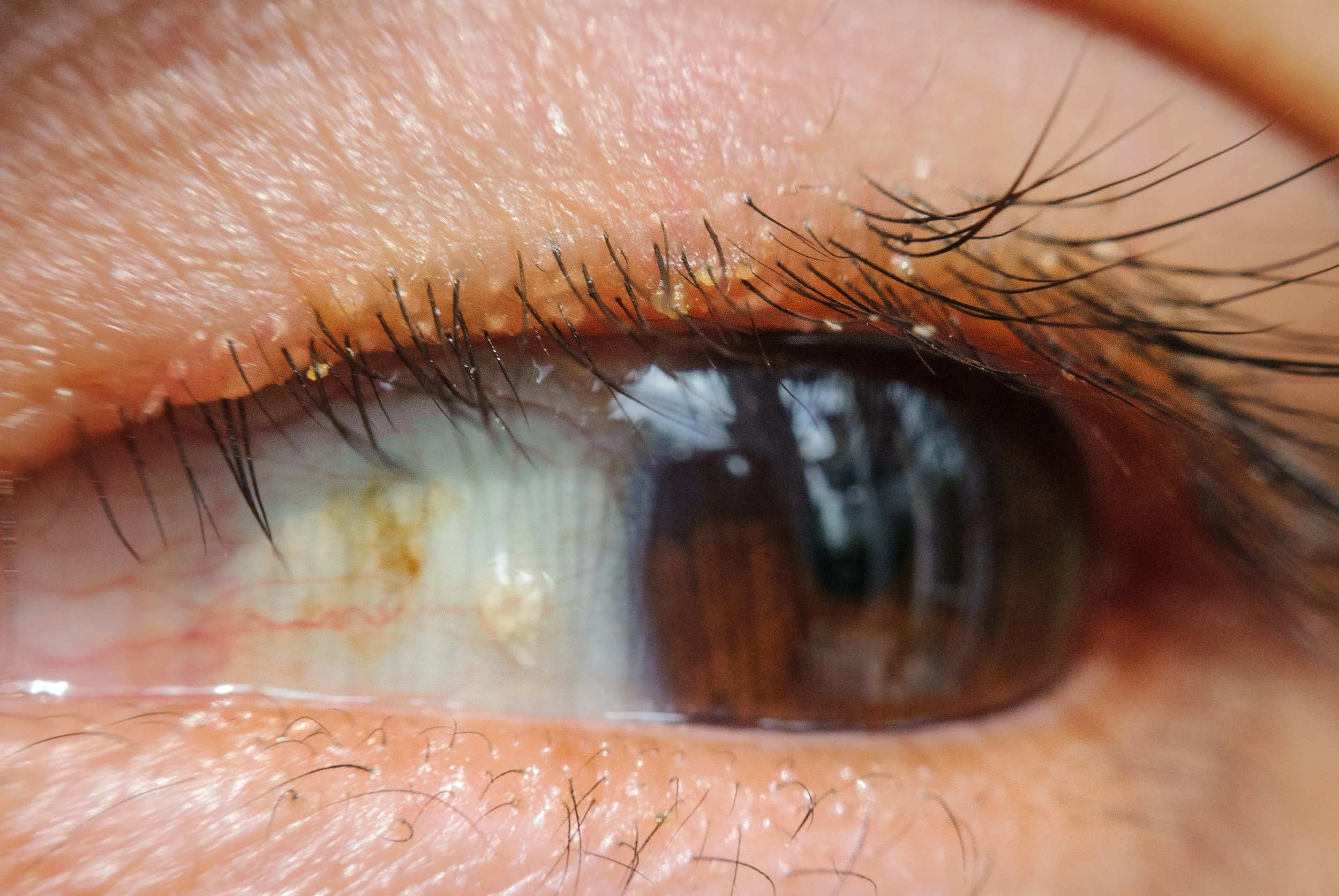 Close-up of a human eye with visible eyelashes and details of the iris and sclera.