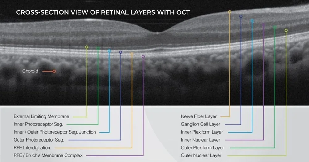 Do You Need an OCT Scan at Your Next Eye Exam?