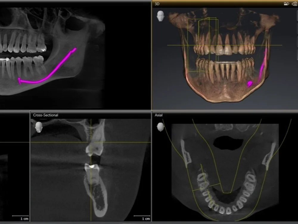 Cbct Resolution Mint To Be Family Dentistry — Technology