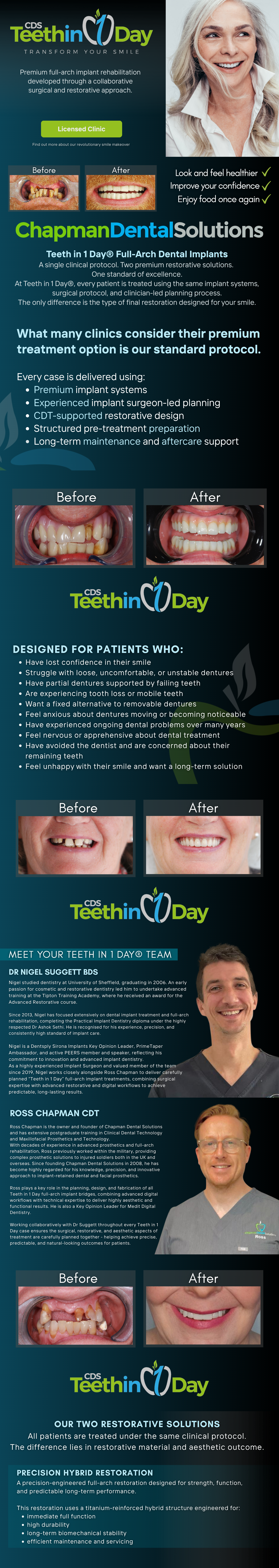 Promotional flyer for CDS Teething Day and dental solutions, featuring before-and-after images of dental treatments, dentists Dr. Nigel Suggett and Ross Chapman, and details about dental implant and restoration options.