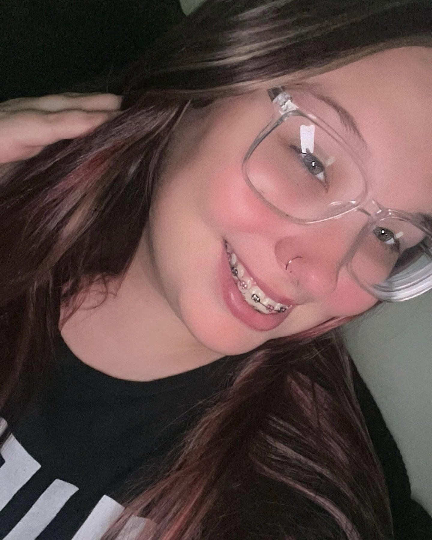 When Hadynn dreamed of getting braces, it wasn&rsquo;t just about a new smile&hellip;it was about confidence, self-worth, and finally being able to do something for herself after years of doing everything on her own.

After spending five years in fos