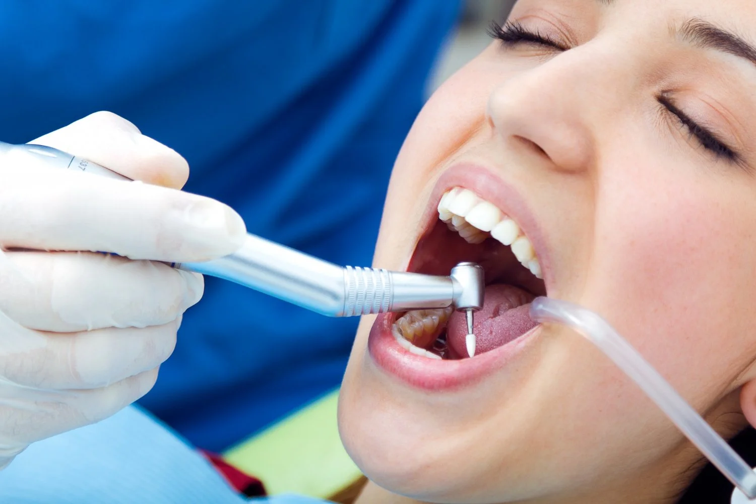 Bad Teeth to Perfect Smile: What a Cosmetic Dentist Can Really Fix