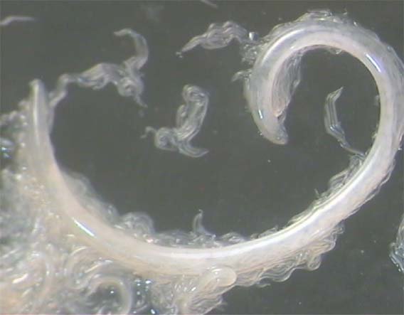 The Tiny Soil Worms That Hunt Crop Pests and Save Billions: How Entomopathogenic Nematodes Are Nature’s Precision Pest-Control System