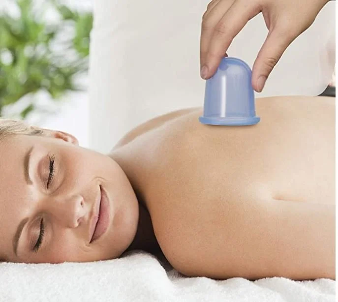 A woman receiving a cupping therapy massage on her back in a relaxing environment.