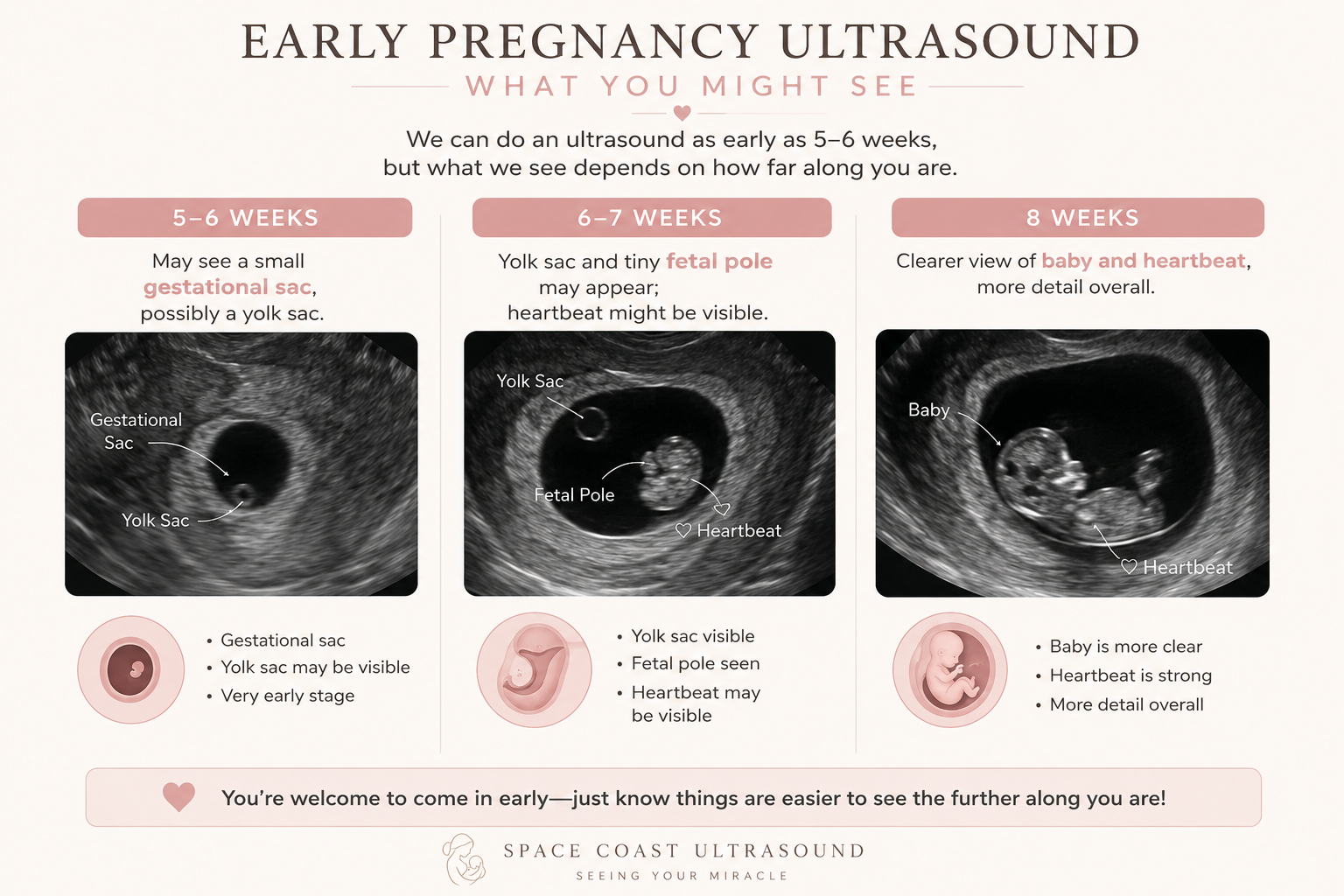 How Early Can You Get an Ultrasound? A Week-by-Week Guide