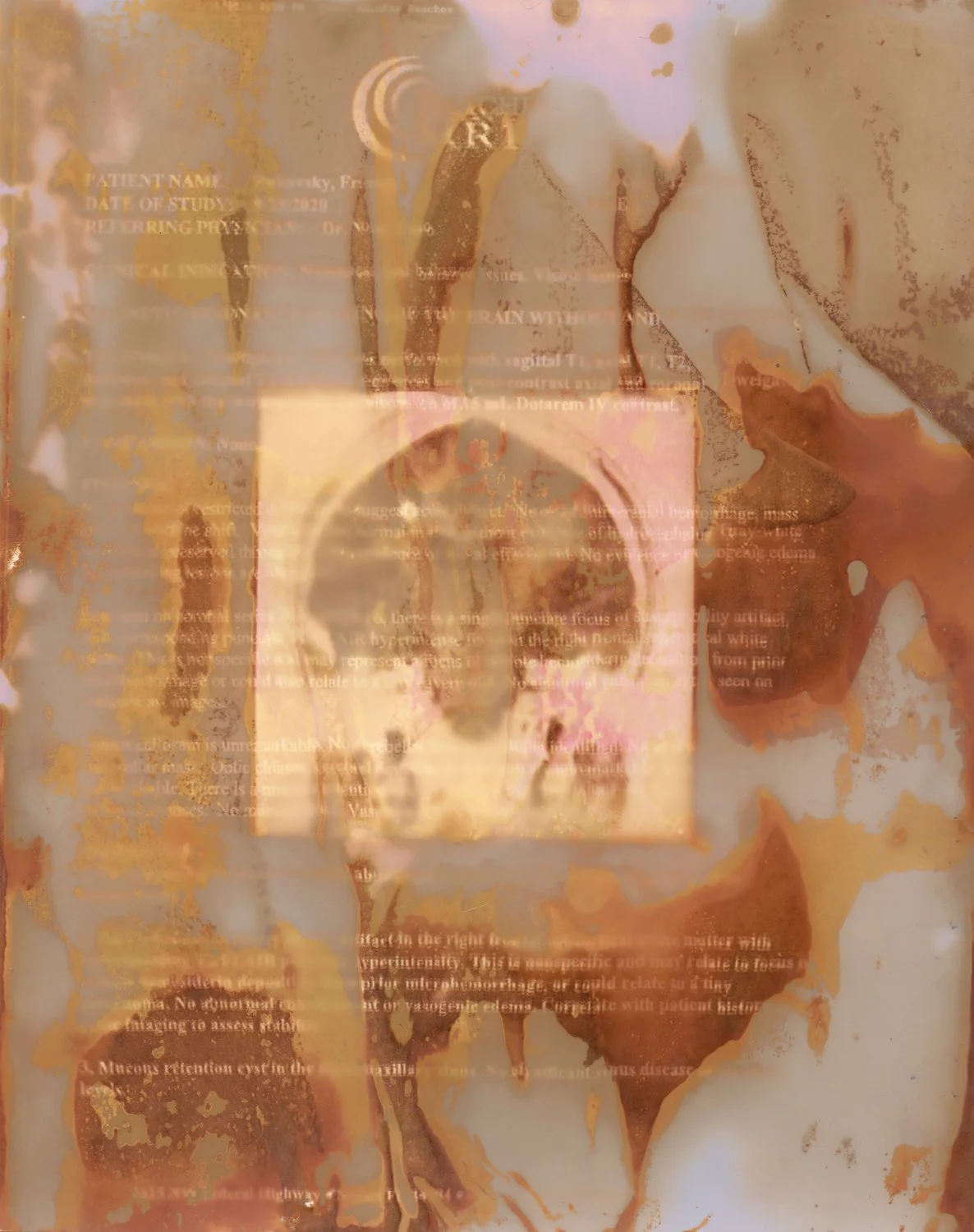 Upheaval: A Kinship Portfolio Share with Frances Bukovsky