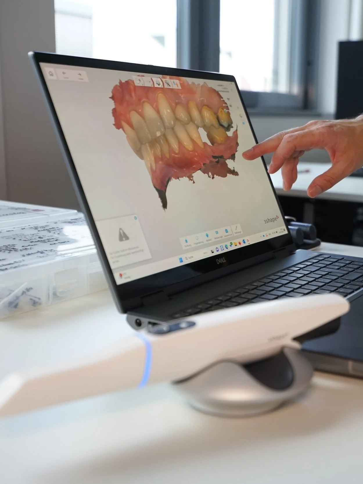 Ein Laptop zeigt eine 3D-Darstellung eines Gebisses auf dem Bildschirm. Es ist eine zahnärztliche Software. Der Bildschirm befindet sich auf einem weißen Tisch, im Hintergrund sind Fenster mit Tageslicht.