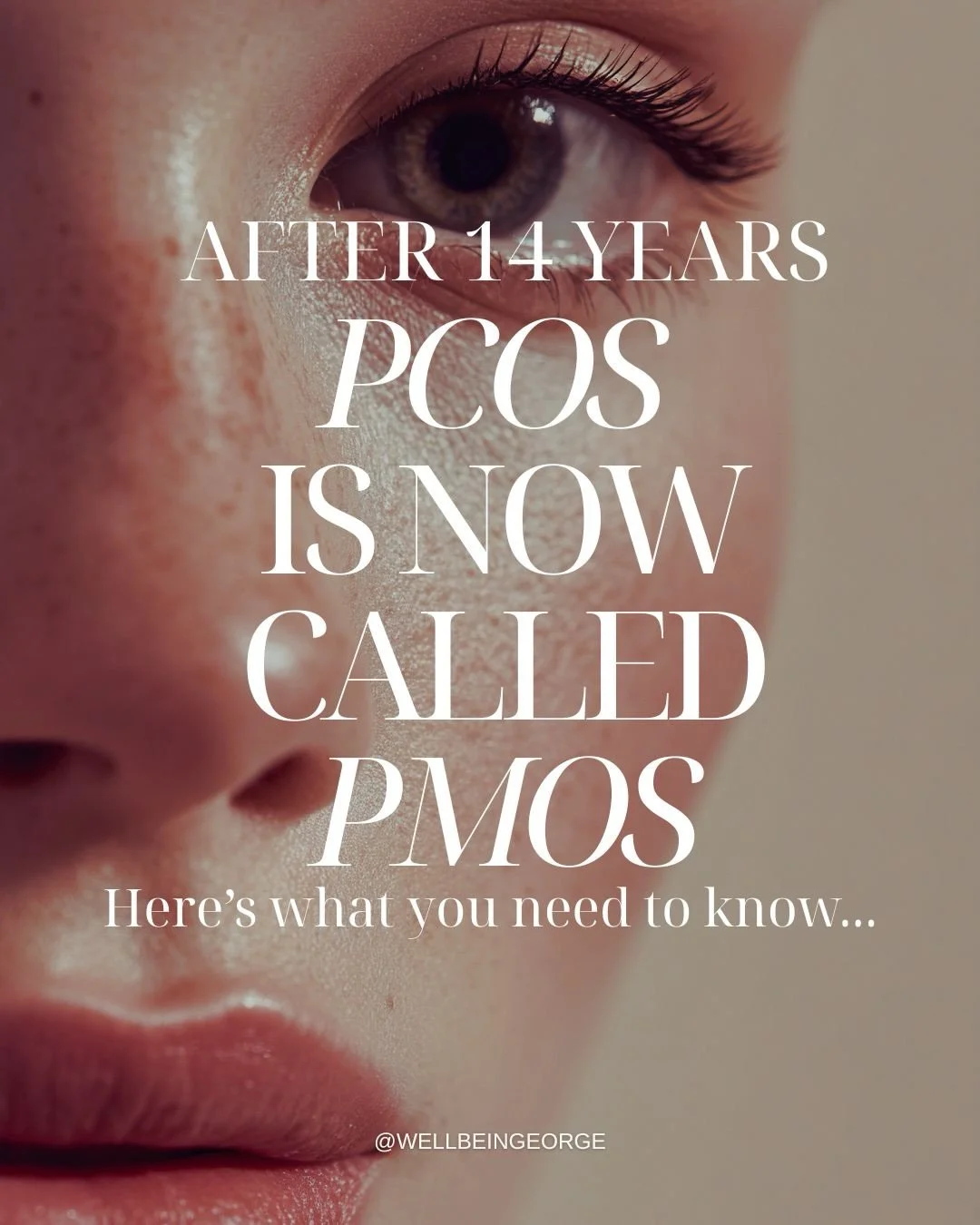 Finally something that will change the conversation and give women acknowledgement for what their experiencing. Hopefully this will reduce confusion and will lead to better outcomes and treatment for women with PMOS. #pmos #pcos #pcosweightloss