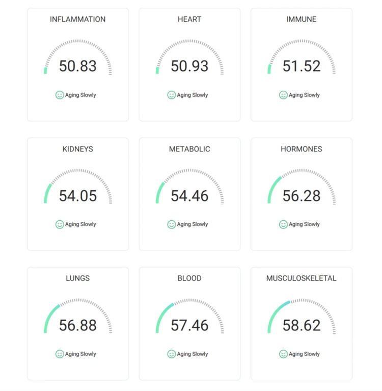 Sample TruAge organ system age report image showing SYMPHONYAge ageing across body systems