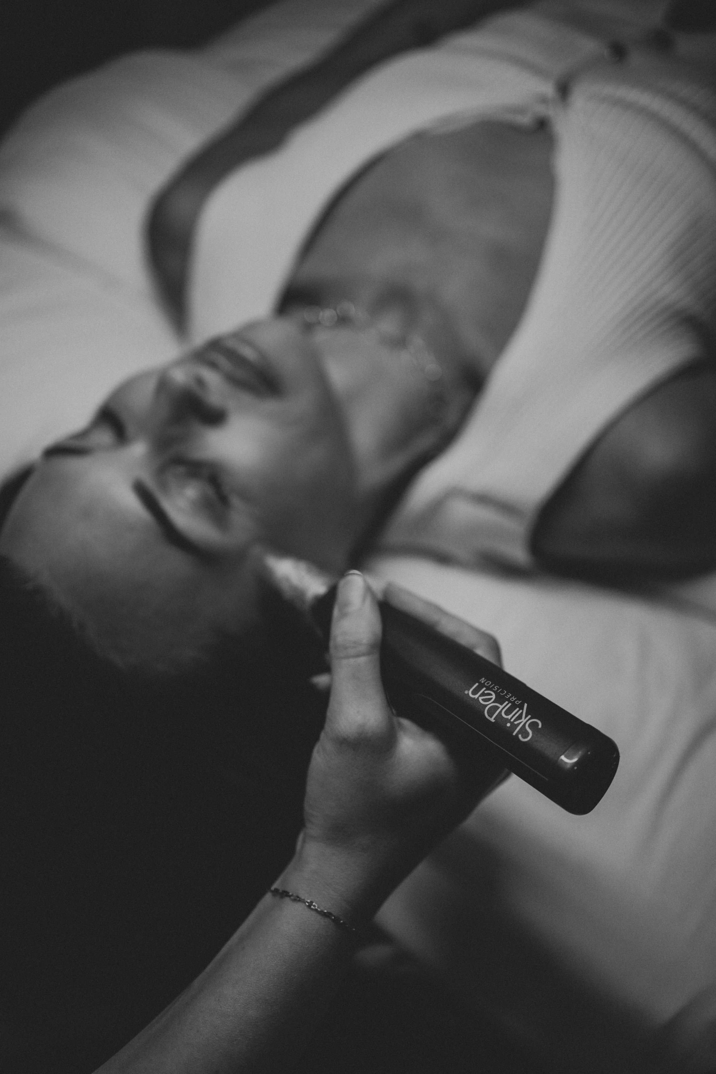 Microneedling: The Gold Standard for Timeless Skin