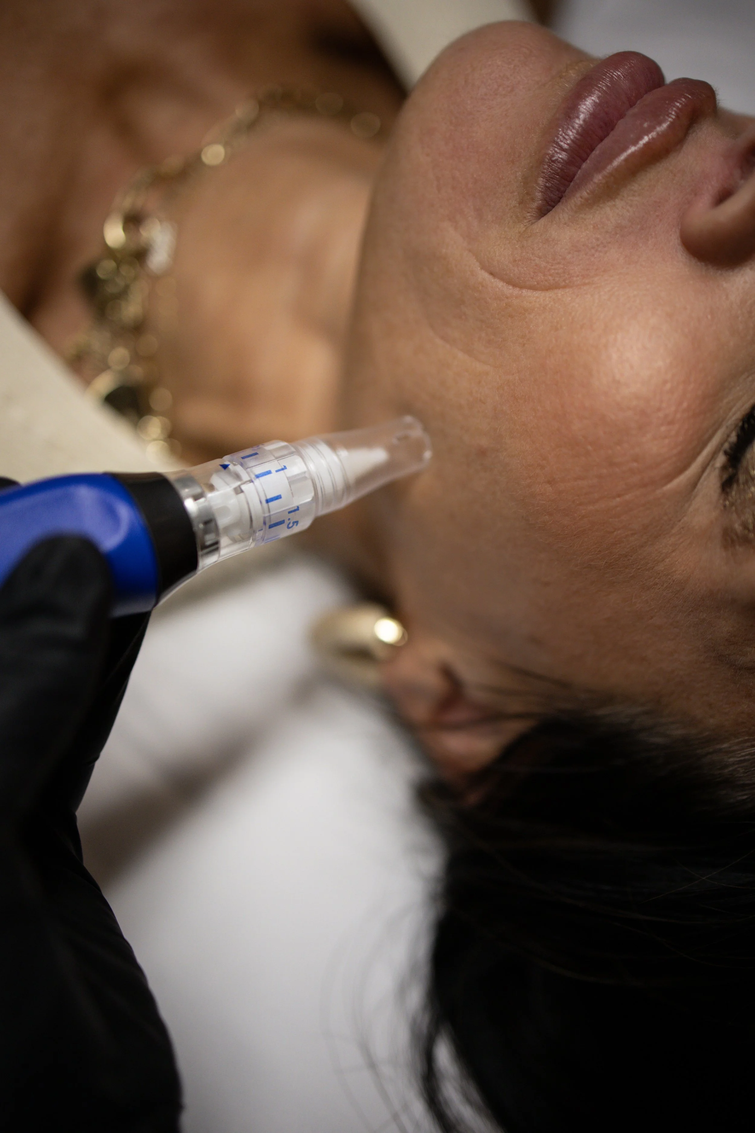 Skinpen, hydrafacials winfield, hormone replacement muse med spa