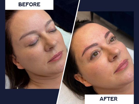 Eyebrow Microblading Before and After Results