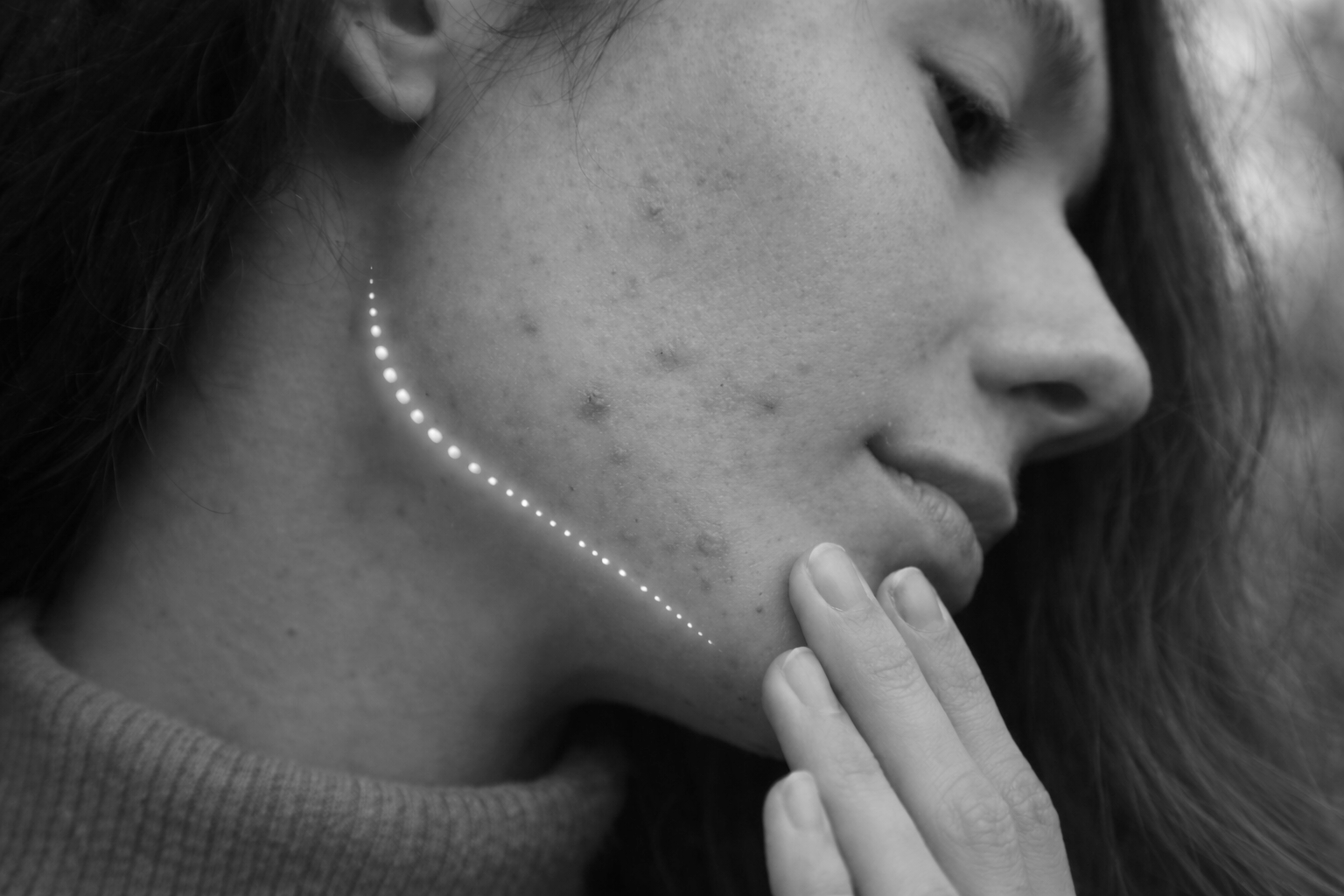 Hormonal Breakouts, Decoded: A TCM Guide to Clearer, Calmer Skin