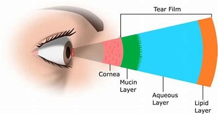 Blog 3 — Laramie Vision Clinic