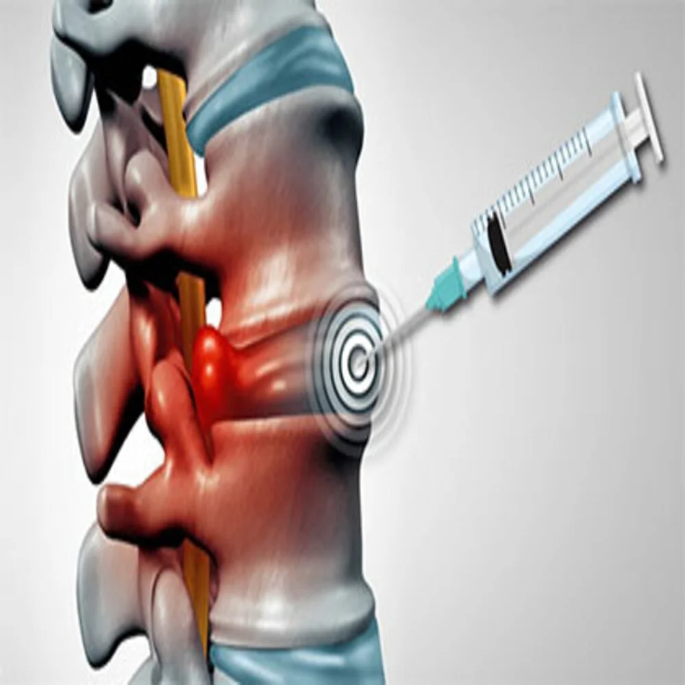 cervical-epidural-steroid-injection [photoutils.com].jpeg