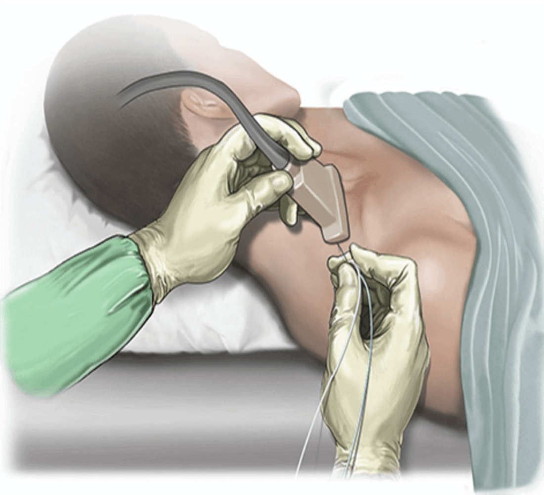 peripheral-nerve-block-upper-limb-1c12c3 [photoutils.com].png
