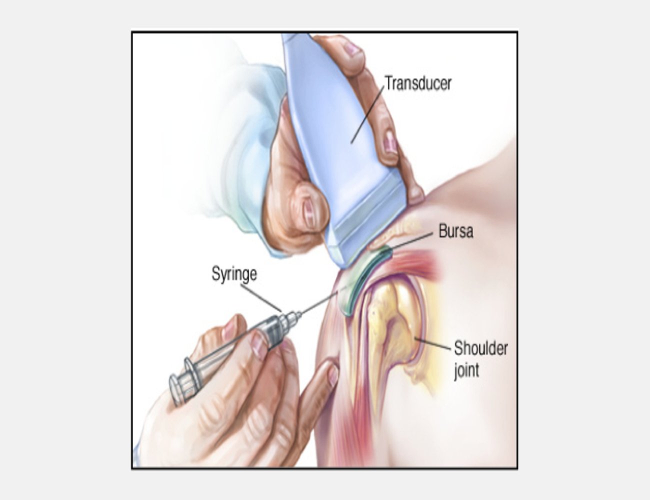 ultrasound-guided-muscle-joint-injections [photoutils.com] (1).jpeg