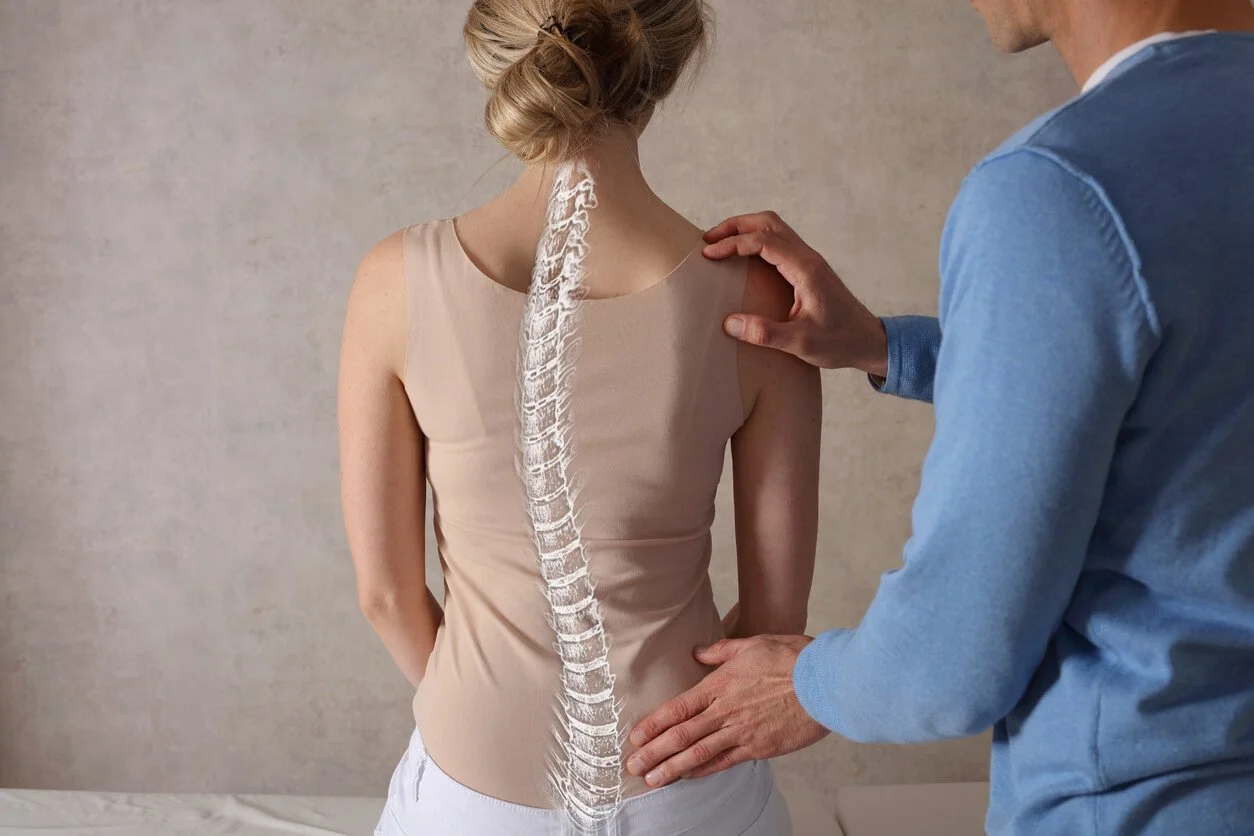Is Scoliosis a Disability? How to Qualify for Social Security Disability Benefits