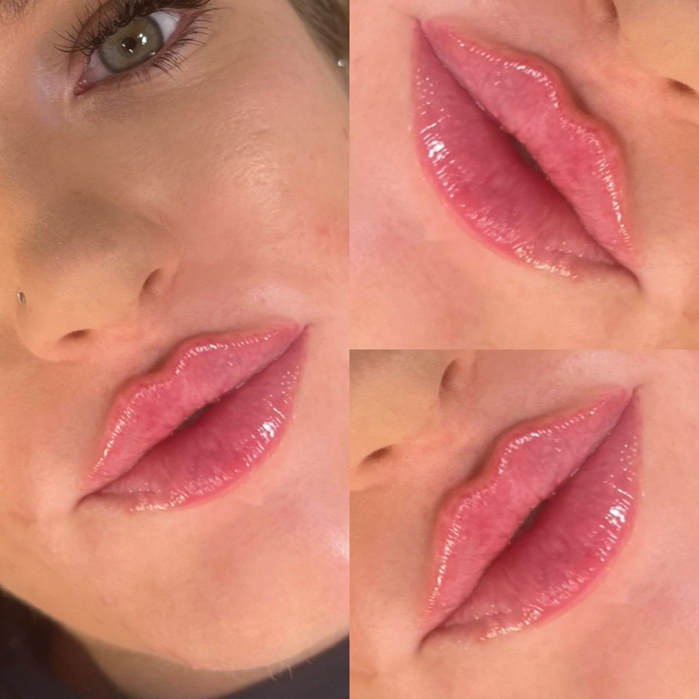 Subtle enhancements, stunning results 🎀 

At NJS we believe beautiful lips start with a focus on enhancing their natural appearance, by carefully applying techniques that boost fullness and define contours, we can create a look that feels effortless