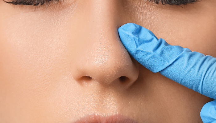 How Much Does Rhinoplasty Cost in Dallas?