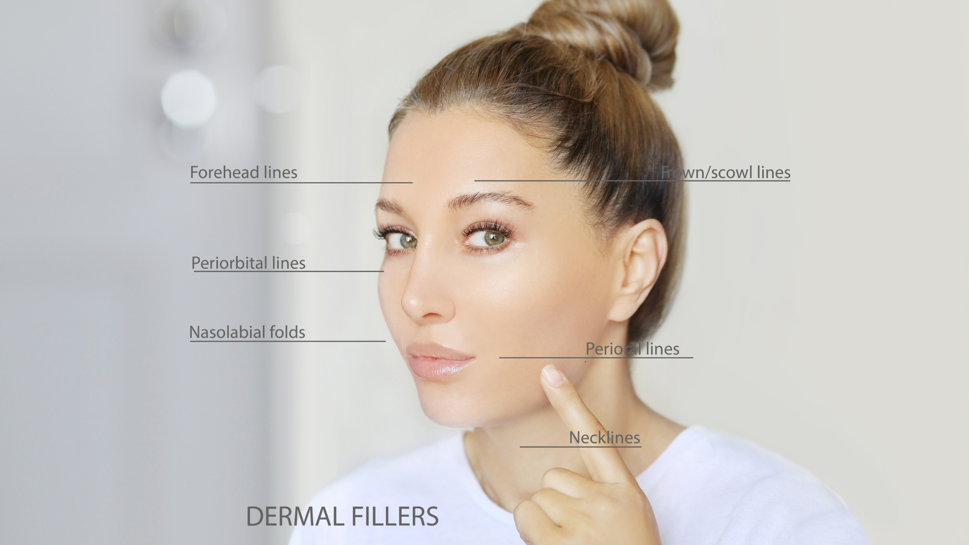 Why Good Filler Is Invisible (and Bad Filler Is Everywhere)