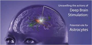 What is the mechanism of action for deep brain stimulation?