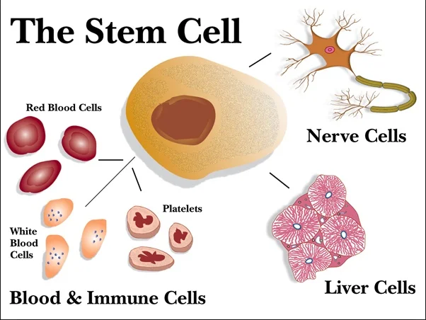 Tips in Case You are Considering a Stem Cell Transplant for Parkinson