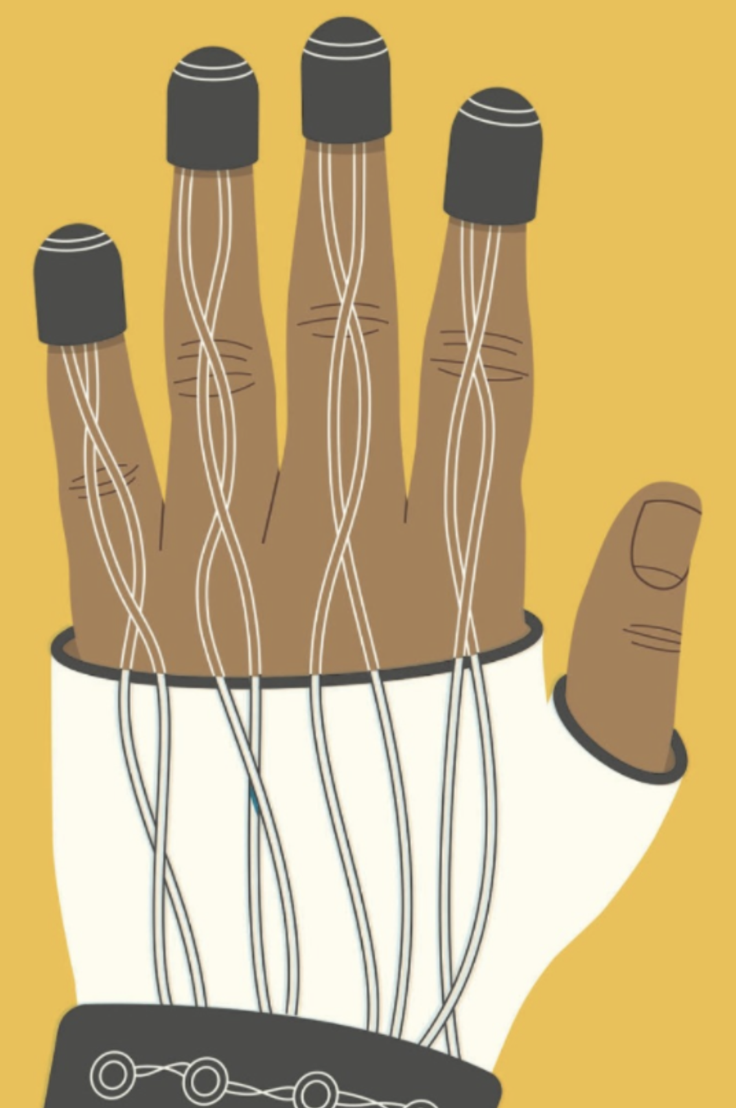 The Vibrating Glove for Parkinson’s: Hope, Hype or Both?