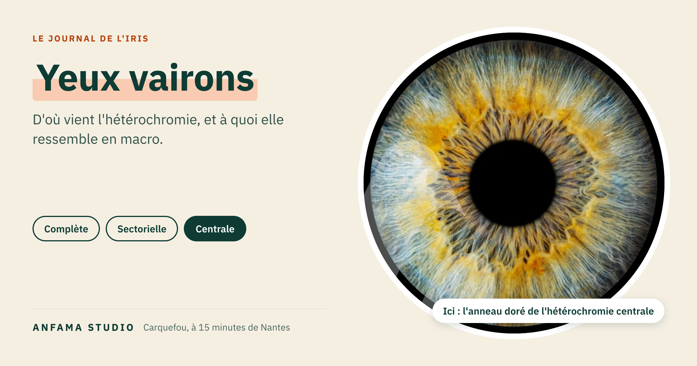 Yeux vairons : d'où vient l'hétérochromie, et à quoi elle ressemble en macro