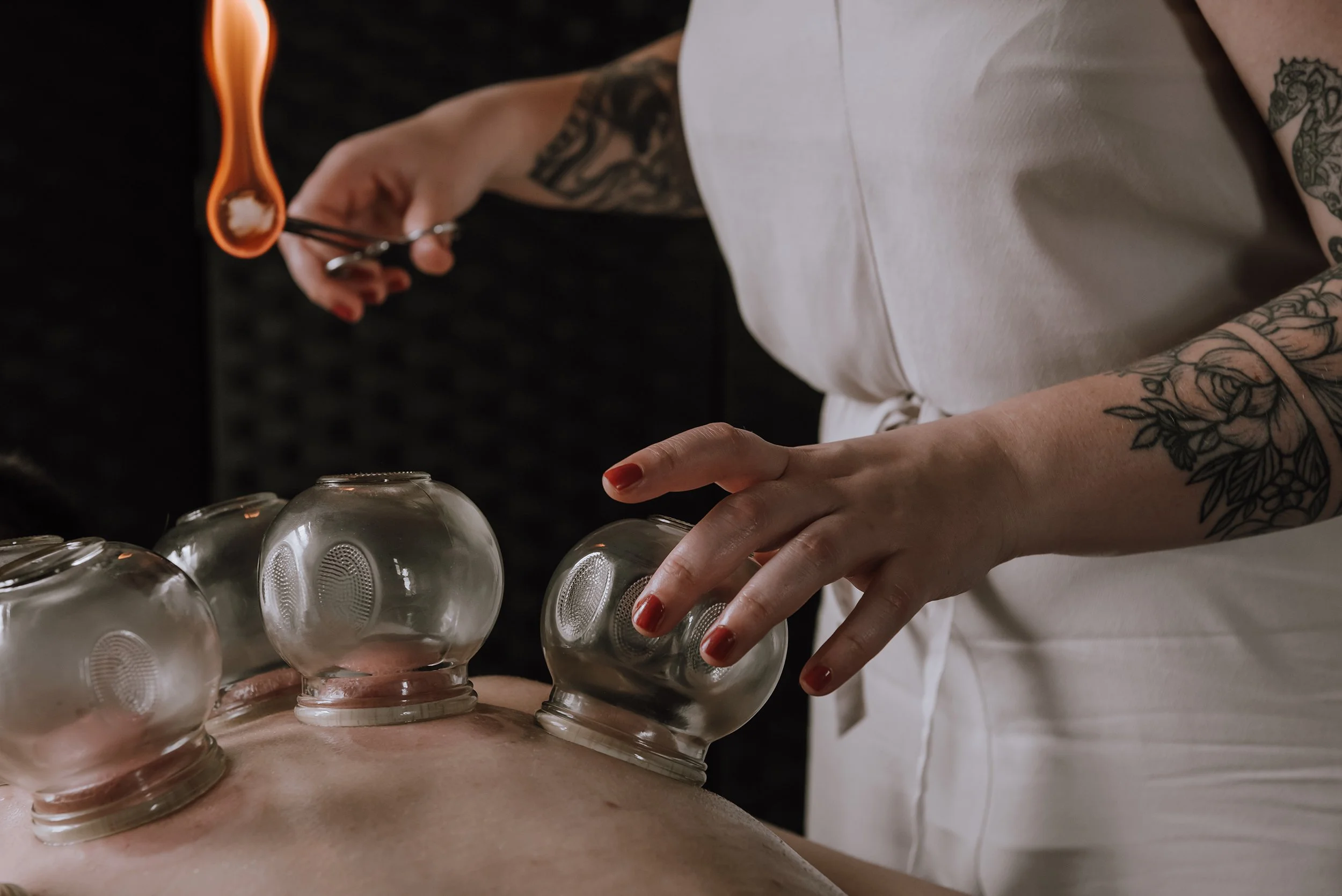 Woman dressed in white, she is using fire cups on a persons back