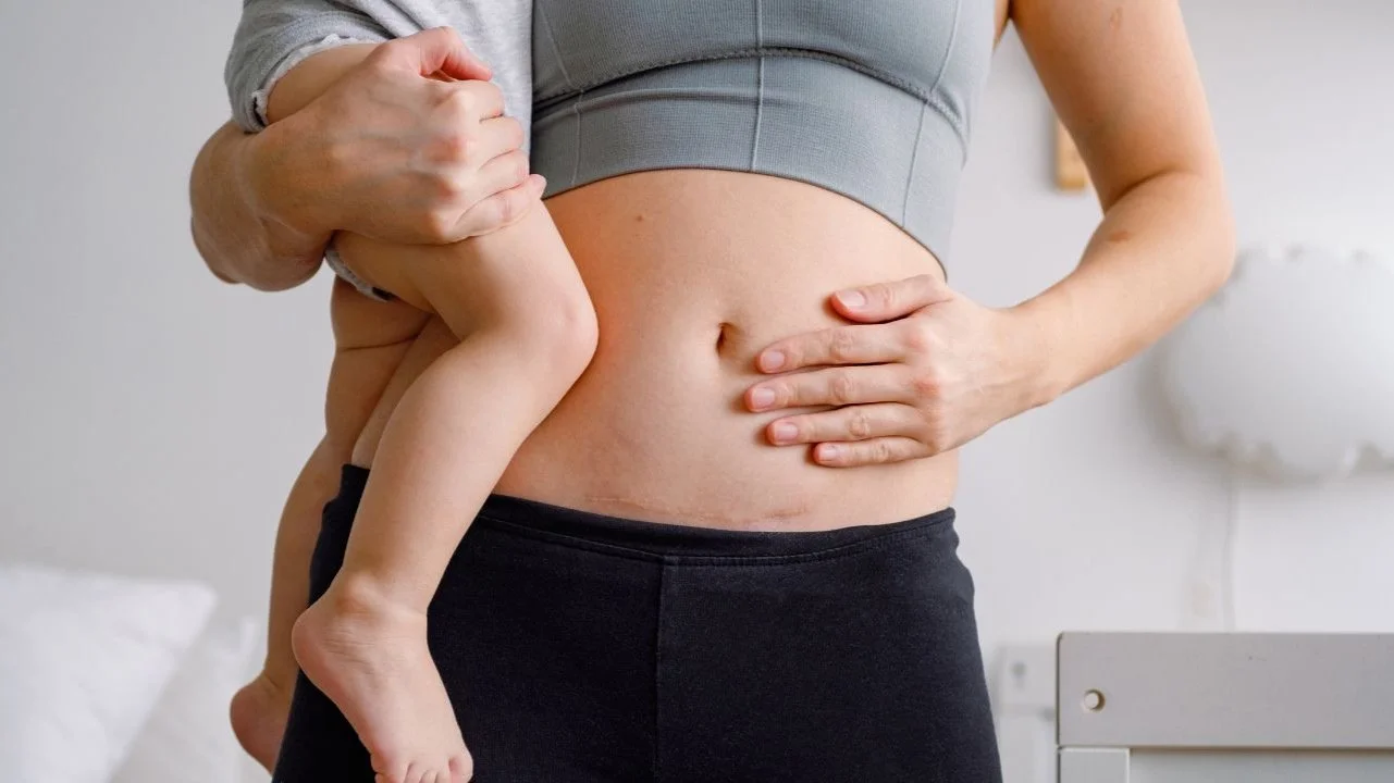 How to Recover From a C-Section With a Toddler at Home