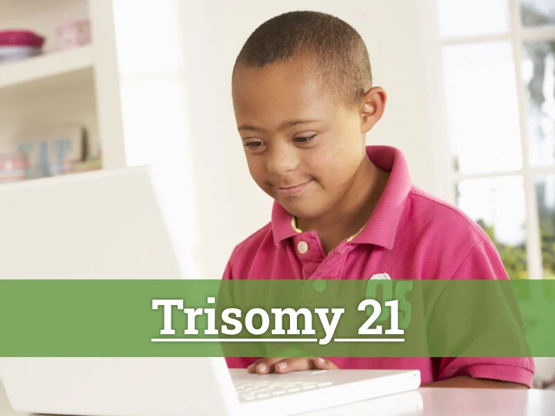TRISOMÍA 21
