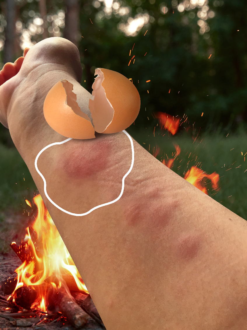 Hot Enough to Fry an Egg