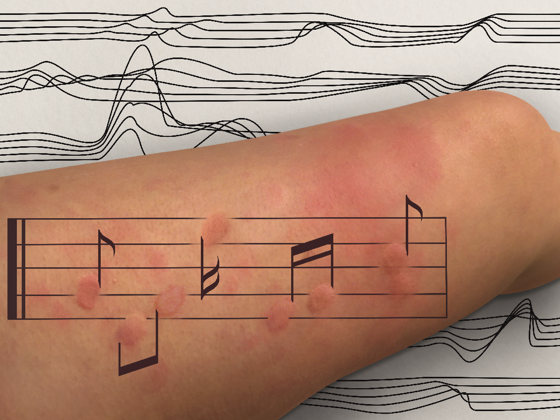 “I will Survive”