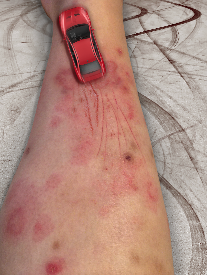 The Itch and The Furious