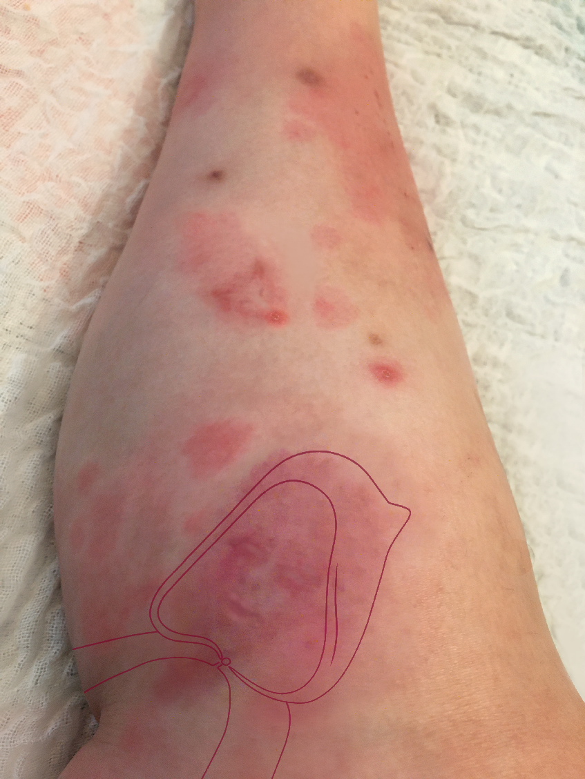 Little Red Riding Hood 