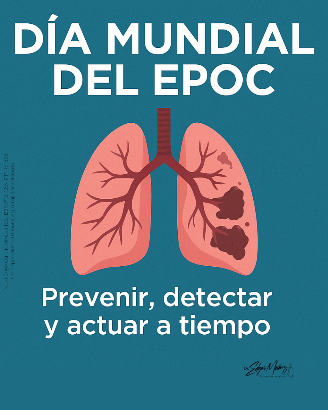Día Mundial del EPOC