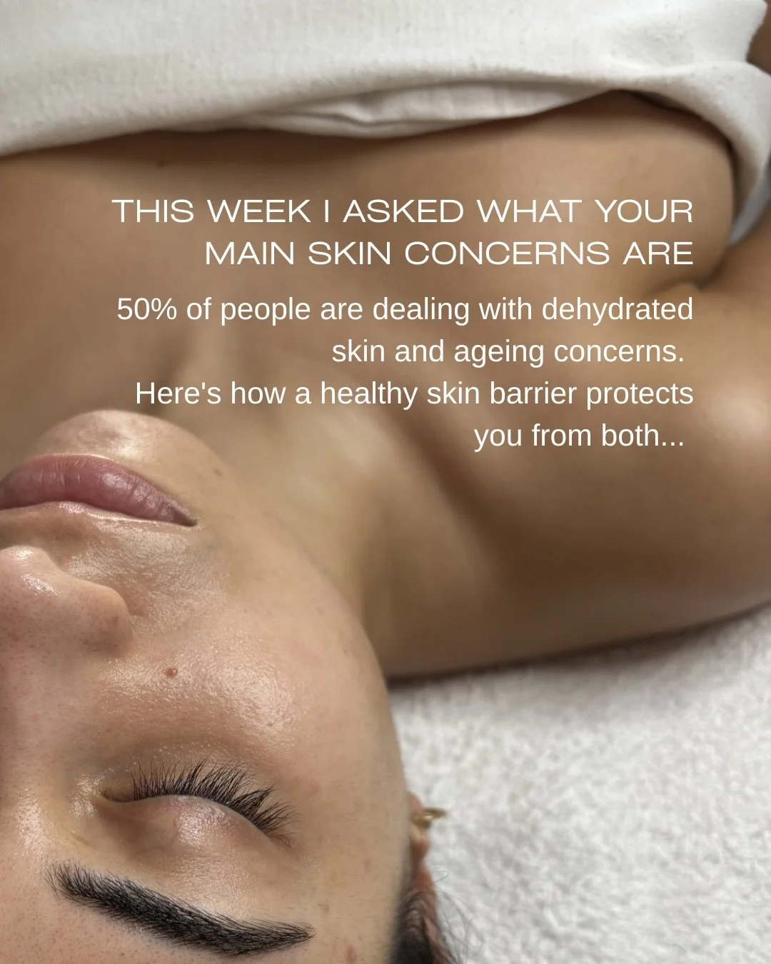 This week I asked what your main skin concerns are and 50% of people are mostly concerned with hydration and ageing. Both are dependent on a heathy skin barrier.

When the skin barrier is intact and heathy, it helps to keep skin hydrated and to tackl