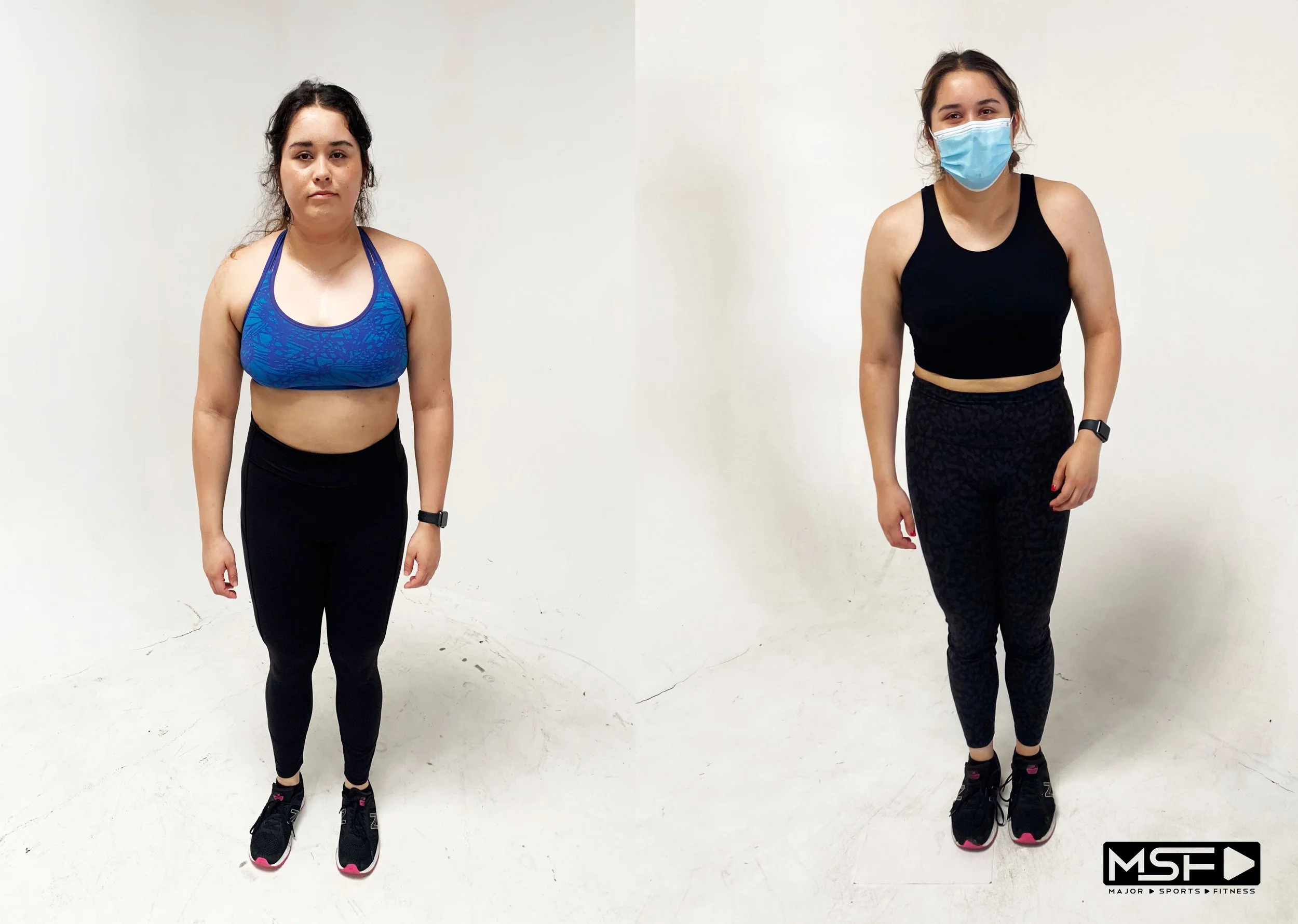 Before n After MSF Tracy.jpg